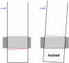 noseclip-modified.gif